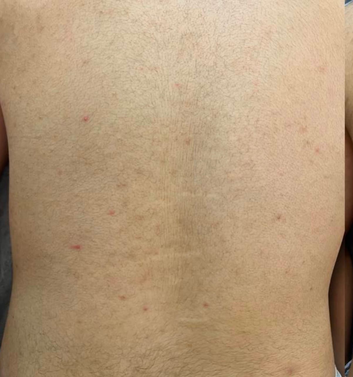 نتیجه یک جلسه فیشال بدن — بعد